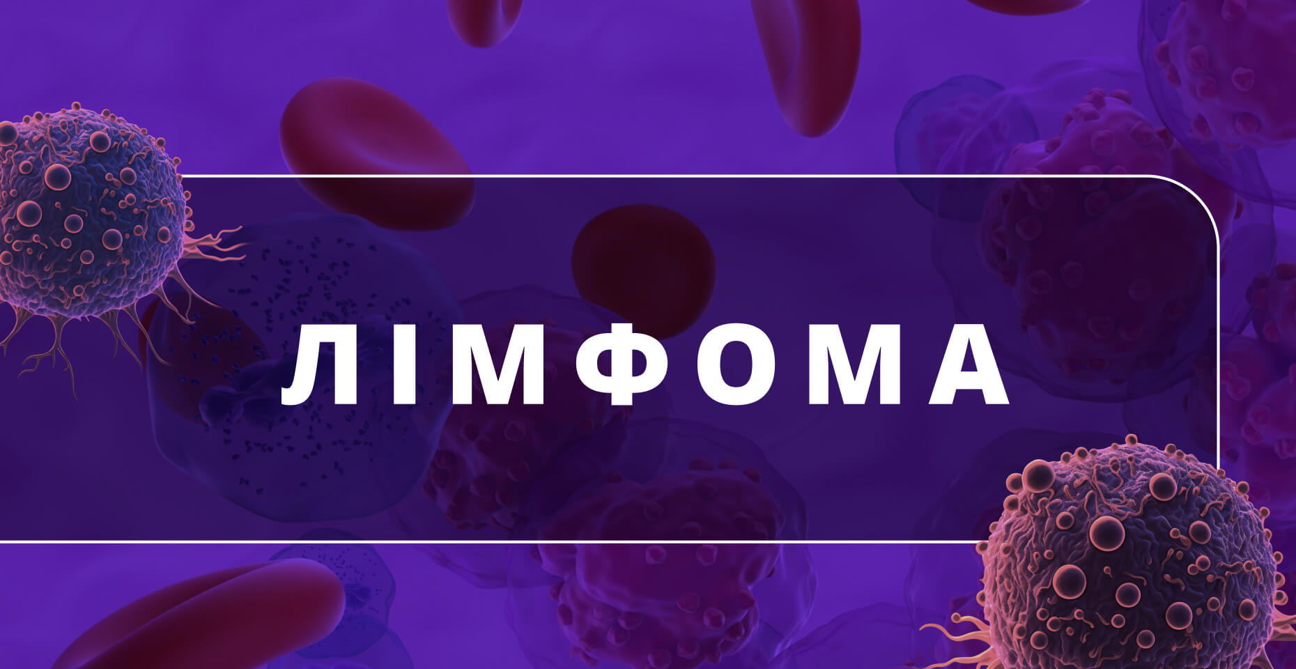 Лімфома